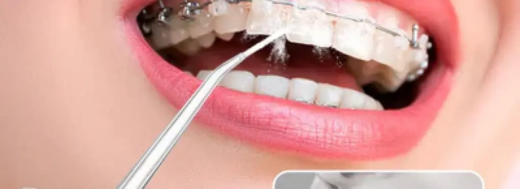 Water Dental Cleaning Device - Perfect cleaning for gums and teeth at an attractive price