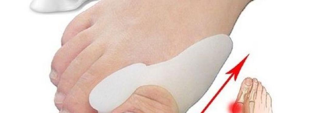 Silicone Toe Corrector for Toe Bruises Treatment - 2 Pieces