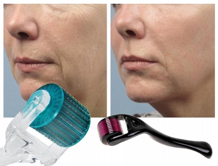 What are the benefits of derma roller for hair and face and how to use it and its price