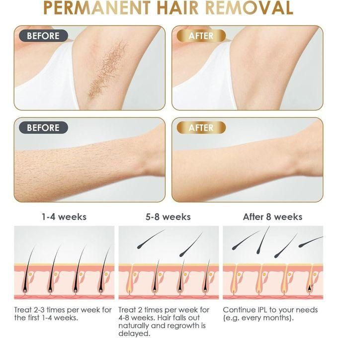 جهاز إزالة الشعر بالليزر المنزلي - تقنية IPL لنتائج دائمة