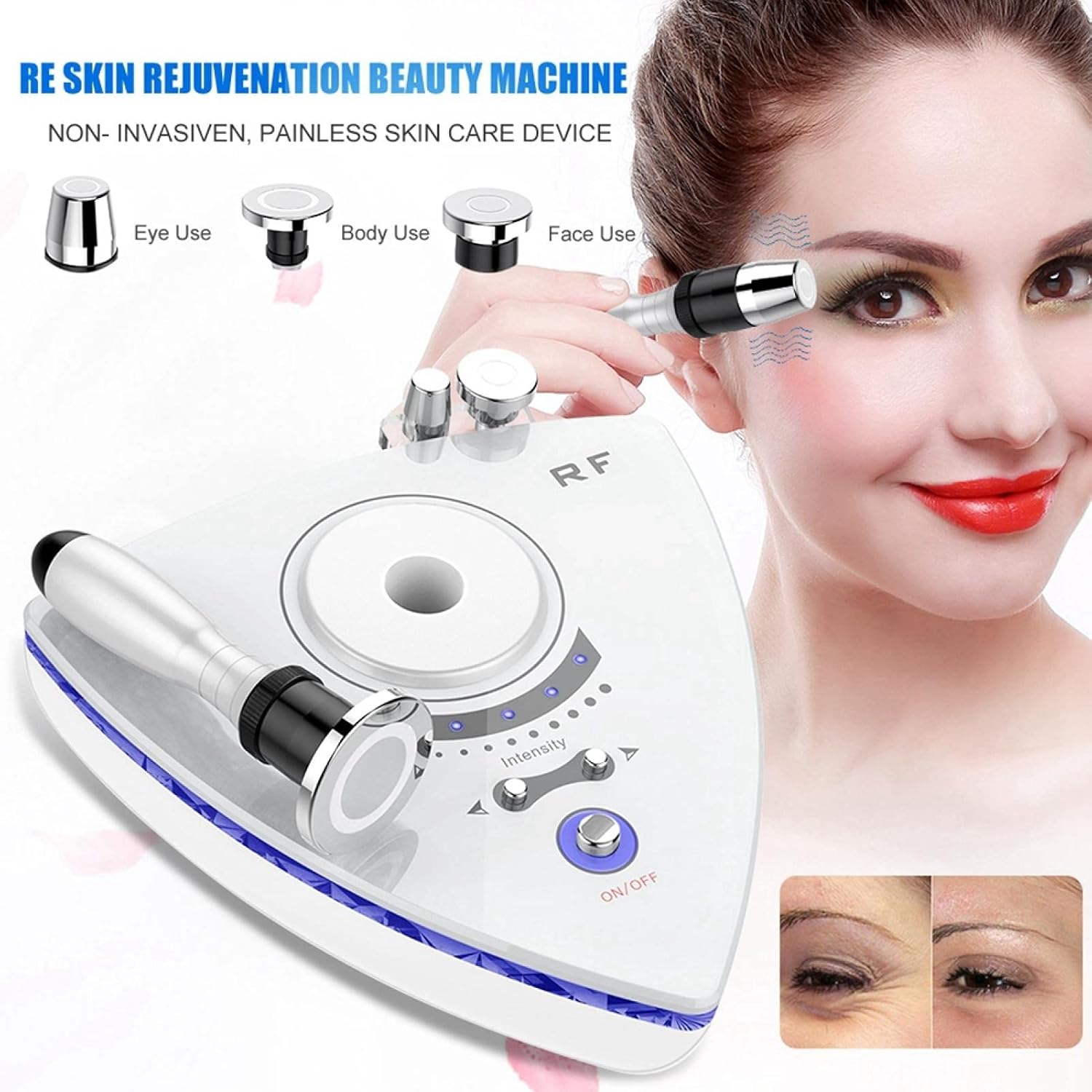 RF Multi-Polar Device (853-22) - Radio frequency skin tightening device 3-in-1