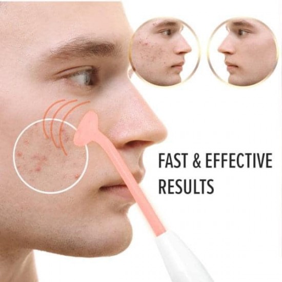 High Frequency Device for Skin and Hair - (3-851) — image 2