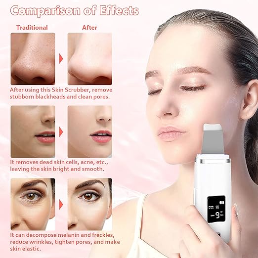 Ultrasonic Skin Cleansing Device - (11-853) — image 3