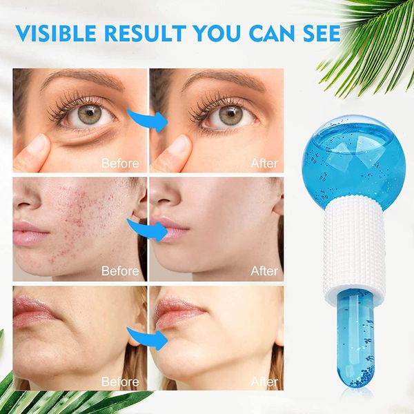 Ice Roller Facial Roller Cold Skin Massagers Crystal Glass Ball For Redness Soothing Face Wrinkle Remover — image 2