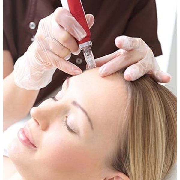 Enzo Dermapen 5 Speeds derma pen for the face enzo for skin purification and cell renewal — image 2