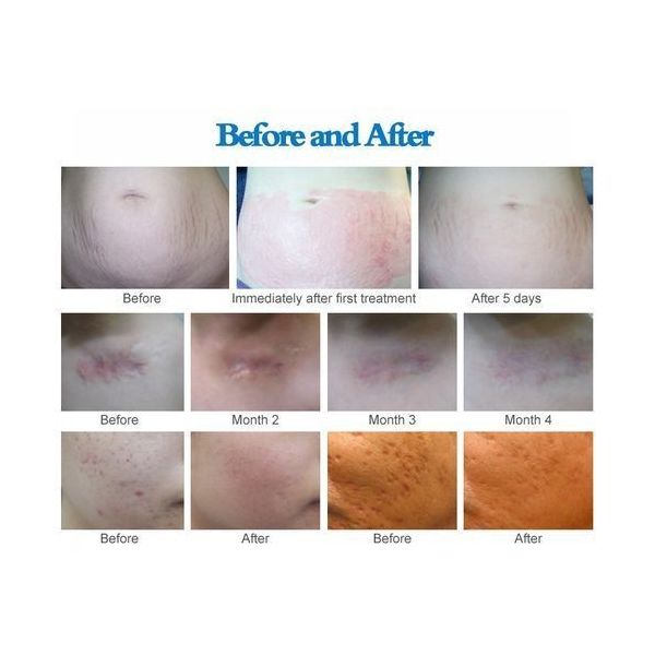 Dr.Pen Derma Pen for Skin M8 — image 3