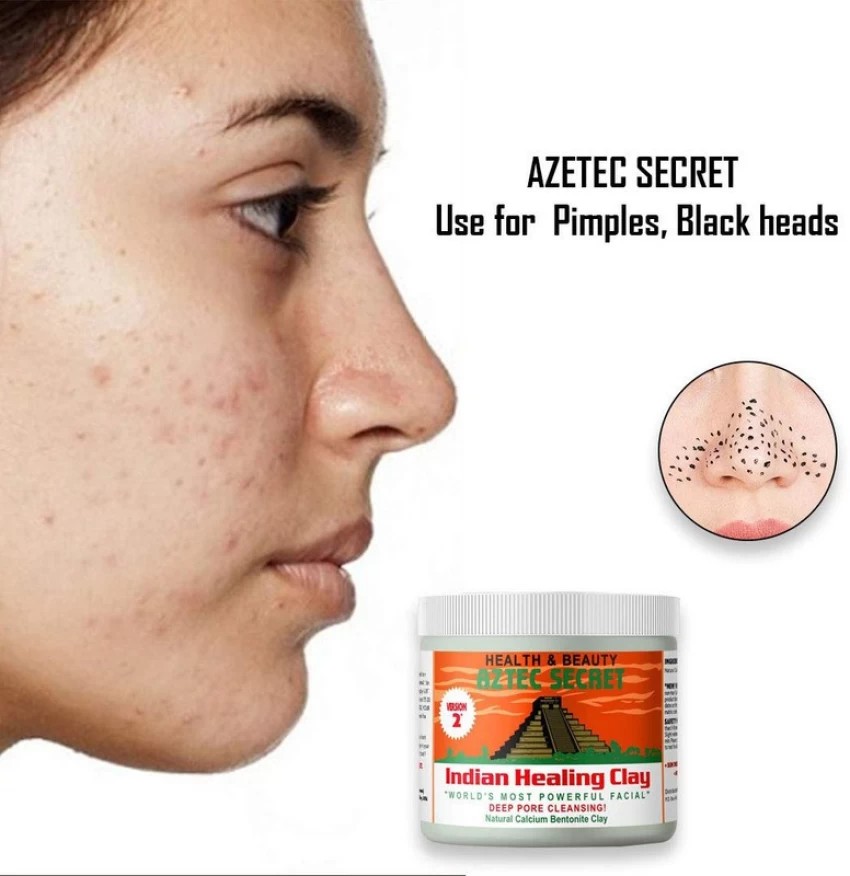 Aztec Secret Indian Clay for Deep Pore Cleansing - 454 g — image 2