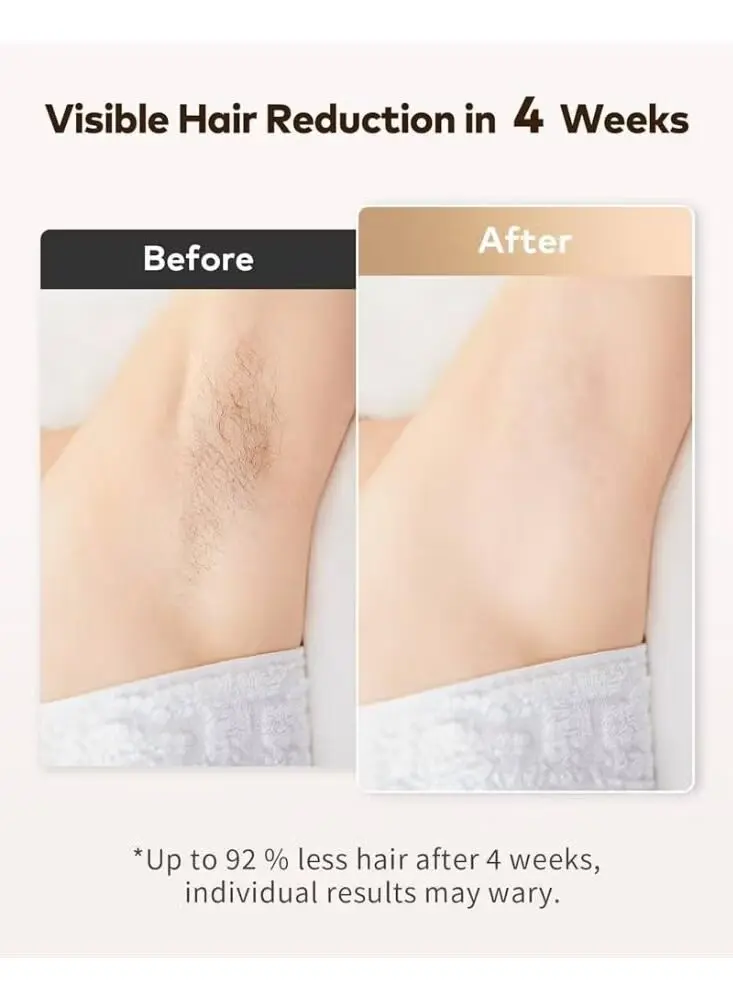 ⁦Moehair Professional Mo-9080 جهاز إزالة الشعر بتقنية Ipl للاستخدام المنزلي لتقليل نمو الشعر وإزالته تدريجياً من الجسم وتحت الإبطين⁩ - الصورة ⁦2⁩